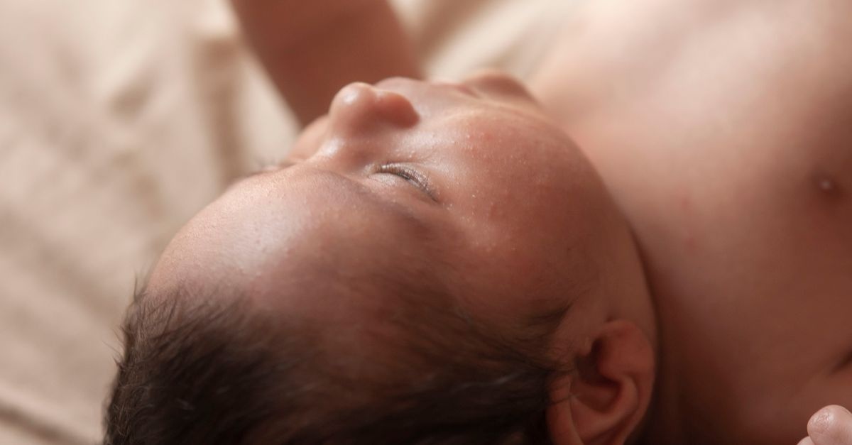 Dermatite nei bambini: rimedi naturali e consigli pratici per calmare la pelle