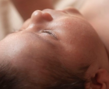 Dermatite nei bambini: rimedi naturali e consigli pratici per calmare la pelle